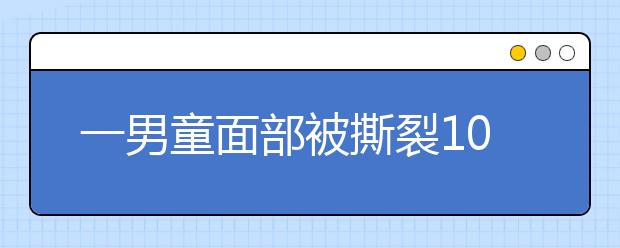 一男童面部被撕裂10多厘米，只因家長忘拔電動車鑰匙！附電動車安全小知識