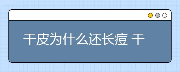 干皮为什么还长痘 干皮长痘痘的原因